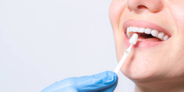 Are There Any Disadvantages to Cosmetic Dentistry?
