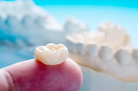 dental crown cost