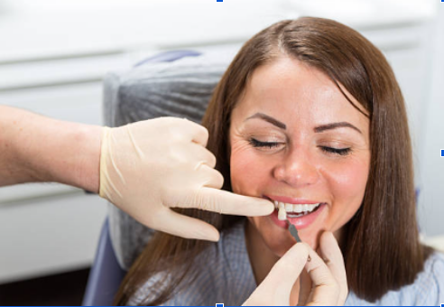 Are Dental Veneers Worth It in Lakeland, FL?