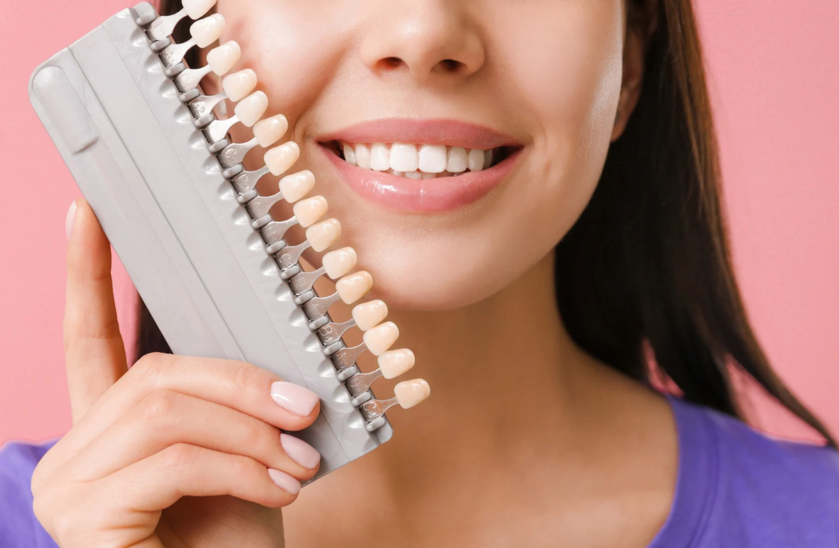 Who Should Avoid Veneers?